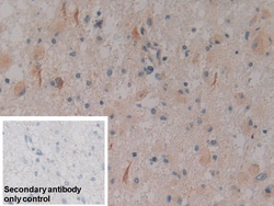 Invitrogen PKC mu Polyclonal Antibody, Invitrogen 200 &mu;L; Unconjugated:Antibodies,