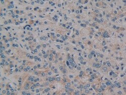 Invitrogen PKC mu Polyclonal Antibody, Invitrogen 20 &mu;L; Unconjugated:Antibodies,