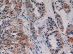 Invitrogen PKC mu Polyclonal Antibody, Invitrogen 20 &mu;L; Unconjugated:Antibodies,