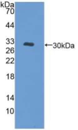 Invitrogen PKC mu Polyclonal Antibody, Invitrogen 20 &mu;L; Unconjugated:Antibodies,