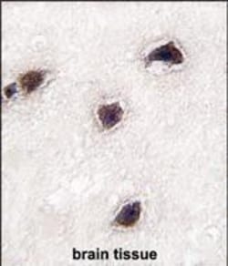 Invitrogen CABP1 Polyclonal Antibody 400 &mu;L; Unconjugated:Antibodies,