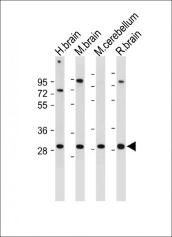 Invitrogen CABP1 Polyclonal Antibody 400 &mu;L; Unconjugated:Antibodies,