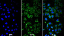 Invitrogen SERPINB1 Polyclonal Antibody, Invitrogen 20 &mu;L; Unconjugated:Antibodies,