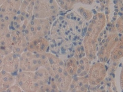 Invitrogen SERPINB1 Polyclonal Antibody, Invitrogen 200 &mu;L; Unconjugated:Antibodies,
