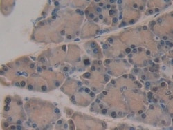Invitrogen SERPINB1 Polyclonal Antibody, Invitrogen 200 &mu;L; Unconjugated:Antibodies,