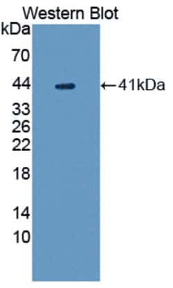 Invitrogen UGGT1 Polyclonal Antibody, Invitrogen 200 &mu;L; Unconjugated:Antibodies,