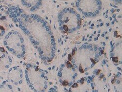 HSF4 Polyclonal Antibody, Invitrogen:Antibodies:Primary Antibodies