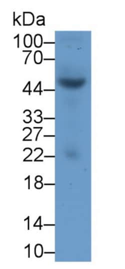 HSF4 Polyclonal Antibody, Invitrogen:Antibodies:Primary Antibodies