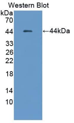 Invitrogen HSF4 Polyclonal Antibody, Invitrogen 200 &mu;L | Buy Online | Invitrogen&trade; | Fisher Scientific