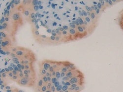 Invitrogen LCN8 Polyclonal Antibody, Invitrogen 20 &mu;L; Unconjugated:Antibodies,
