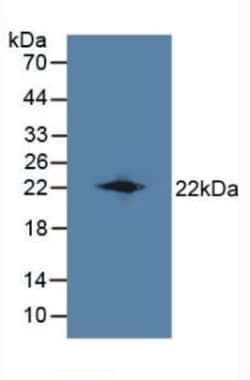 Invitrogen LCN8 Polyclonal Antibody, Invitrogen 20 &mu;L; Unconjugated:Antibodies,