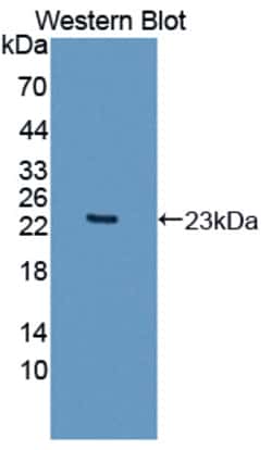 Invitrogen Apolipoprotein O Polyclonal Antibody, Invitrogen 20 &mu;L; Unconjugated:Antibodies,