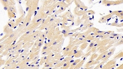 Invitrogen ARK5 Polyclonal Antibody, Invitrogen 20 &mu;L | Buy Online | Invitrogen&trade; | Fisher Scientific