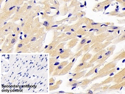 Invitrogen ARK5 Polyclonal Antibody, Invitrogen 20 &mu;L | Buy Online | Invitrogen&trade; | Fisher Scientific