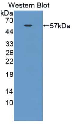 Invitrogen ARK5 Polyclonal Antibody, Invitrogen 20 &mu;L | Buy Online | Invitrogen&trade; | Fisher Scientific