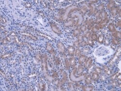 PEBP1 Polyclonal Antibody, Invitrogen 200 &mu;L; Unconjugated:Antibodies,