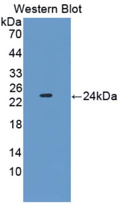 PEBP1 Polyclonal Antibody, Invitrogen 200 &mu;L; Unconjugated:Antibodies,