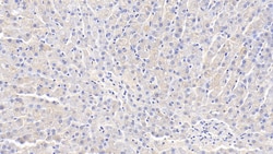 Invitrogen Adiponectin Polyclonal Antibody, Invitrogen 200 &mu;L; Unconjugated:Antibodies,