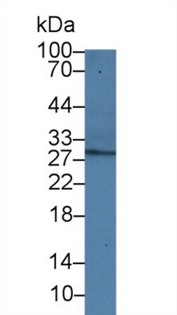 Invitrogen Adiponectin Polyclonal Antibody, Invitrogen 200 &mu;L; Unconjugated:Antibodies,