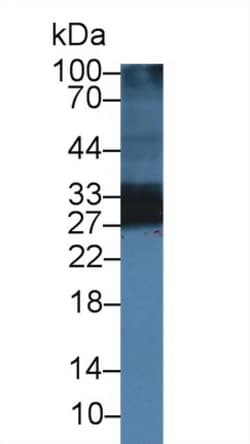 Invitrogen Adiponectin Polyclonal Antibody, Invitrogen 200 &mu;L; Unconjugated:Antibodies,