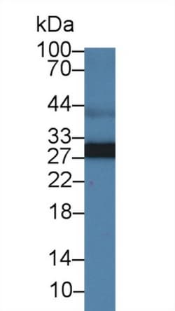 Invitrogen Adiponectin Polyclonal Antibody, Invitrogen 200 &mu;L; Unconjugated:Antibodies,