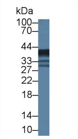 ABHD7 Polyclonal Antibody, Invitrogen:Antibodies:Primary Antibodies