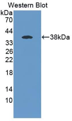 ABHD7 Polyclonal Antibody, Invitrogen:Antibodies:Primary Antibodies