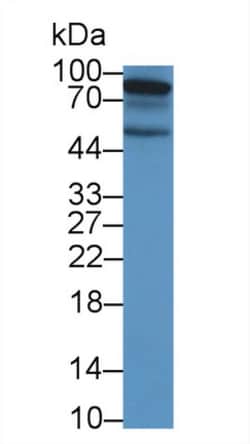 Invitrogen EphA10 Polyclonal Antibody, Invitrogen 200 &mu;L; Unconjugated:Antibodies,