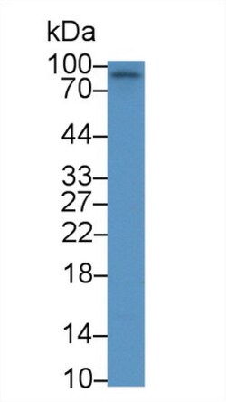 Invitrogen EphA10 Polyclonal Antibody, Invitrogen 200 &mu;L; Unconjugated:Antibodies,