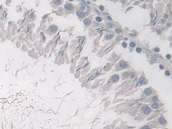 PDE4B Polyclonal Antibody, Invitrogen 200 &mu;L; Unconjugated:Antibodies,