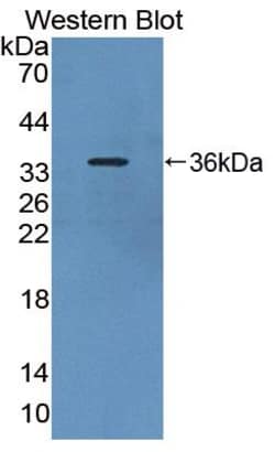 PDE4B Polyclonal Antibody, Invitrogen 200 &mu;L; Unconjugated:Antibodies,