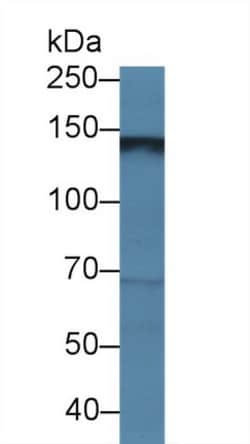 Invitrogen HEPH Polyclonal Antibody, Invitrogen 20 &mu;L; Unconjugated:Antibodies,