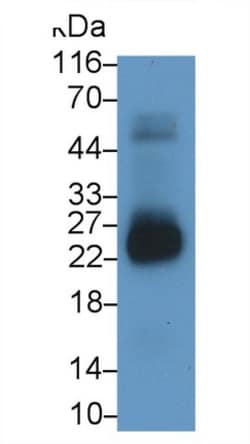 CSN1S1 Polyclonal Antibody, Invitrogen:Antibodies:Primary Antibodies