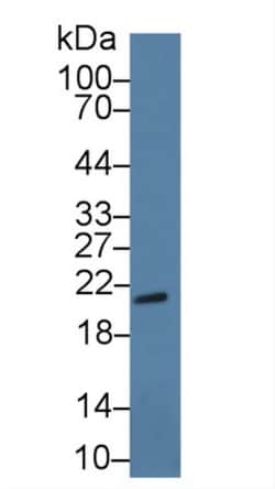 CSN1S1 Polyclonal Antibody, Invitrogen:Antibodies:Primary Antibodies