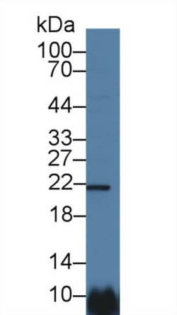 CSN1S1 Polyclonal Antibody, Invitrogen:Antibodies:Primary Antibodies