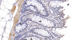 Invitrogen KPNA3 Polyclonal Antibody, Invitrogen 20 &mu;L; Unconjugated:Antibodies,
