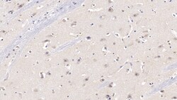 Invitrogen KPNA3 Polyclonal Antibody, Invitrogen 20 &mu;L; Unconjugated:Antibodies,