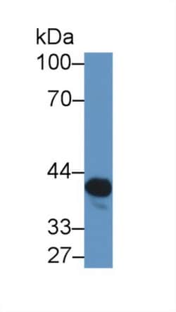 NAT2 Polyclonal Antibody, Invitrogen:Antibodies:Primary Antibodies