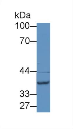 NAT2 Polyclonal Antibody, Invitrogen:Antibodies:Primary Antibodies