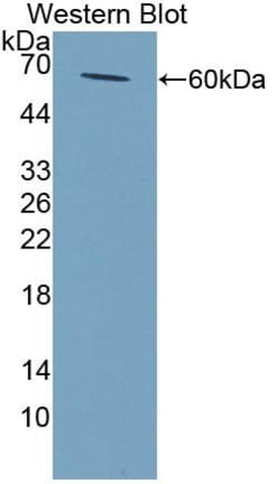 NAT2 Polyclonal Antibody, Invitrogen:Antibodies:Primary Antibodies
