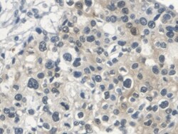 Invitrogen SERPINB3/SERPINB4 Polyclonal Antibody, Invitrogen:Antibodies:Primary