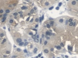 Invitrogen SERPINB3/SERPINB4 Polyclonal Antibody, Invitrogen:Antibodies:Primary