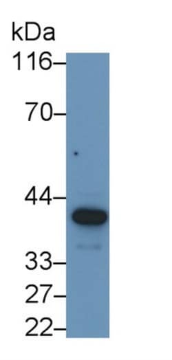 Invitrogen SERPINB3/SERPINB4 Polyclonal Antibody, Invitrogen:Antibodies:Primary