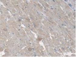 Invitrogen CES1 Polyclonal Antibody, Invitrogen 20 &mu;L; Unconjugated:Antibodies,