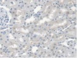 Invitrogen CES1 Polyclonal Antibody, Invitrogen 20 &mu;L; Unconjugated:Antibodies,