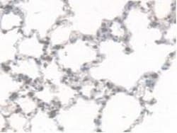 Invitrogen CES1 Polyclonal Antibody, Invitrogen 20 &mu;L; Unconjugated:Antibodies,