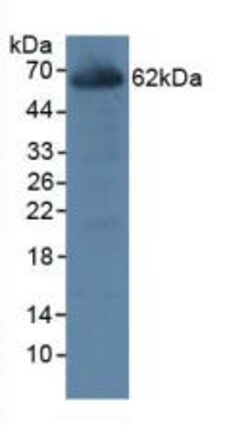 Invitrogen CES1 Polyclonal Antibody, Invitrogen 20 &mu;L; Unconjugated:Antibodies,