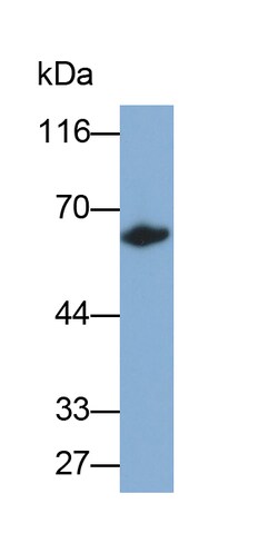 Invitrogen CES1 Polyclonal Antibody, Invitrogen 200 &mu;L; Unconjugated:Antibodies,
