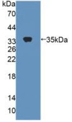 Invitrogen CES1 Polyclonal Antibody, Invitrogen 20 &mu;L; Unconjugated:Antibodies,
