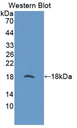 NUTF2 Polyclonal Antibody, Invitrogen:Antibodies:Primary Antibodies